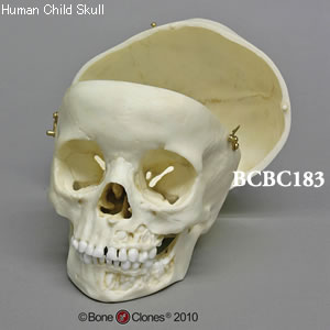 BCBC183 小児頭蓋骨模型　5才・顎開放、頭蓋冠分離型