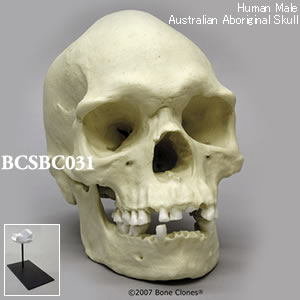 BCSBC031 オーストラリアアボリジニ男性頭蓋骨模型