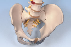 脊柱模型の骨盤