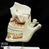 VE281 成人歯列模型の左側面