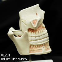VE281 成人歯列模型の右側面