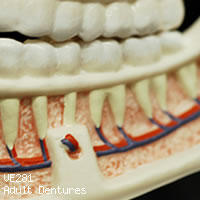 VE281 成人歯列模型の下顎開放・左側
