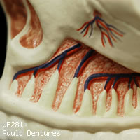 VE281 成人歯列模型の上顎開放・左側