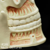 VE281 成人歯列模型の上下顎開放・右側