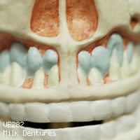 VE282　乳歯歯列模型、上顎開放