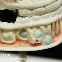 VE282　乳歯歯列模型、下顎開放