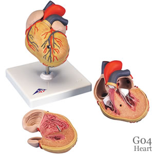 心臓模型、左心室肥大・2分解