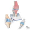 膝の関節断面 3分解モデル