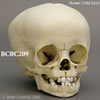 小児の頭蓋骨模型 16ヶ月 BCBC209