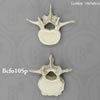 正常腰椎（L3）と関節炎腰椎（L3）の比較模型、2個セット