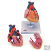 心臓、バイパス付・2分解モデル