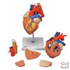 心臓 2倍大・5分解モデル 食道・気管・大動脈付