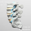 X線ファントム神経根付き腰椎（L3-Sacrum）