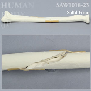 骨折性橈骨（左・大） SAW1018-23 ソーボーン模擬骨