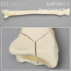 骨折性橈骨（左・大） SAW1027-1 ソーボーン模擬骨