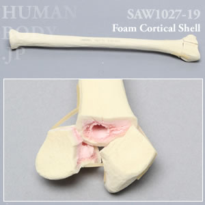 骨折性橈骨（左・大） SAW1027-19 ソーボーン模擬骨
