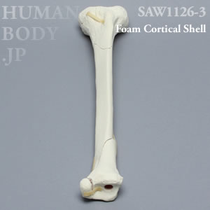 多発骨折性脛骨（左・大） SAW1126-3 ソーボーン模擬骨