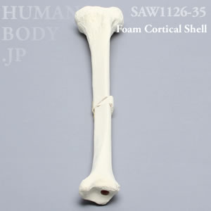 骨折性脛骨（左・大） SAW1126-35 ソーボーン模擬骨