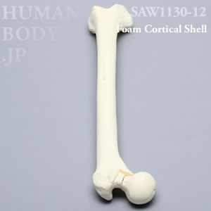 骨折性大腿骨（左・大） SAW1130-12 ソーボーン模擬骨