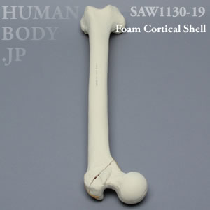 骨折性大腿骨（左・大） SAW1130-19 ソーボーン模擬骨