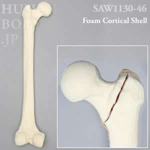 骨折性大腿骨（左・大） SAW1130-46 ソーボーン模擬骨