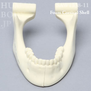 骨折性下顎骨（大） SAW1338-11 ソーボーン模擬骨