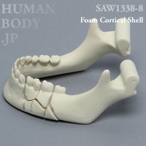 骨折性下顎骨（大） SAW1338-8 ソーボーン模擬骨