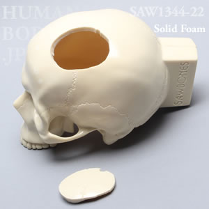 骨折性頭蓋骨 SAW1344-22 ソーボーン模擬骨