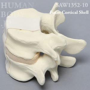 腰椎（L4-L5） SAW1352-10 ソーボーン模擬骨