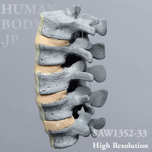 SAW1352-33 X線ファントム骨粗鬆症腰椎（L1-L5）病理モデル