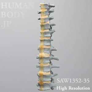 SAW1352-35 X線ファントム・骨粗鬆症腰椎（T7-L5 ）病理モデル