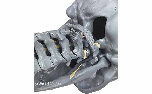 X線ファントム・頭蓋骨と頸椎（C1-C7）SAW1345-92背面
